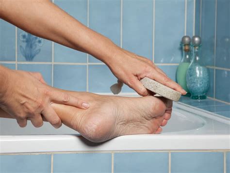 Experience the Magic of Smooth Skin with the Callus Removing Pot